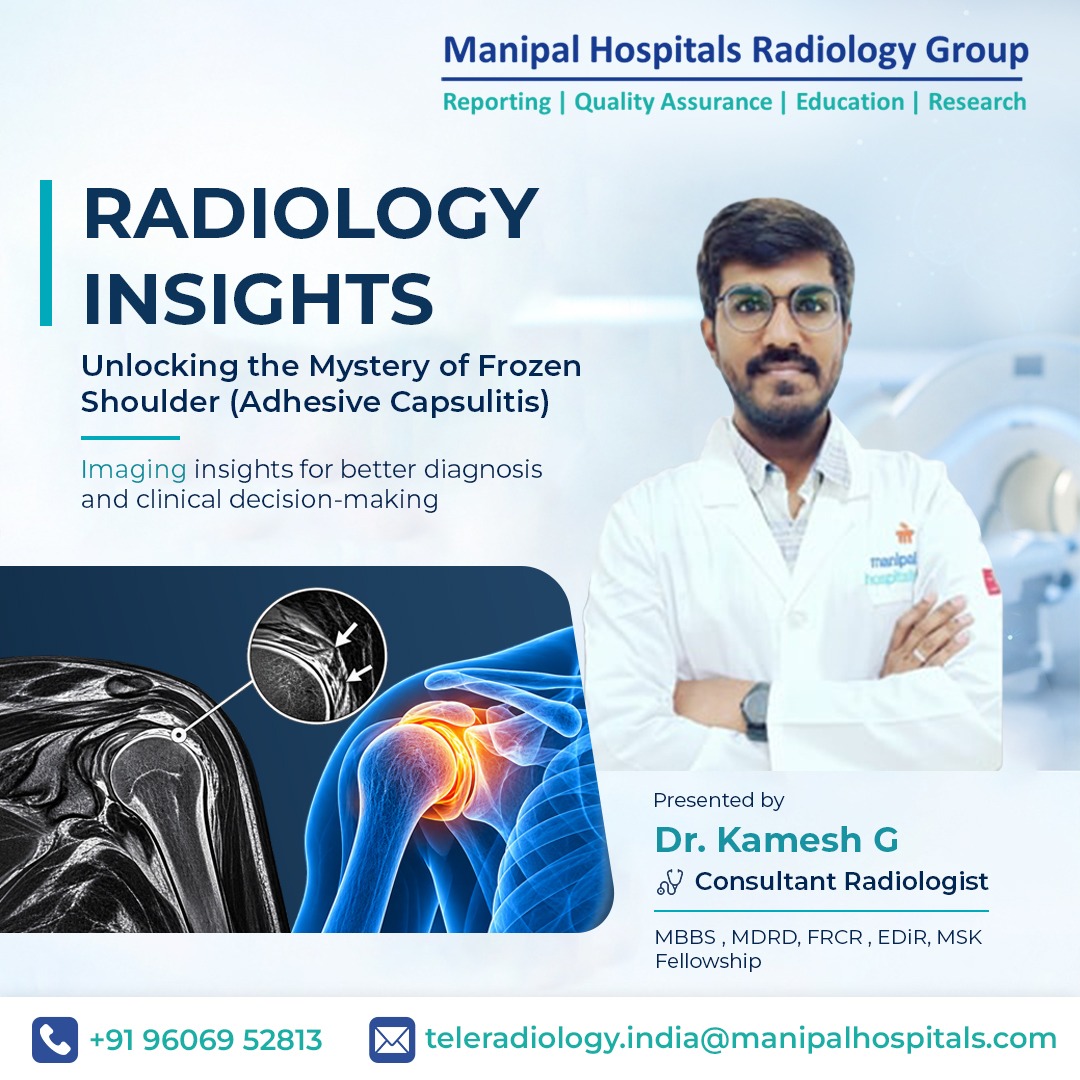 Radiology Insights: Unlocking the Mystery of Frozen Shoulder